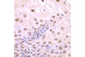 Immunohistochemistry of paraffin-embedded human esophagus using SQSTM1 antibody. (SQSTM1 Antikörper)