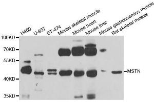 Western blot analysis of extracts of various cell lines, using MSTN antibody. (MSTN Antikörper  (AA 267-375))