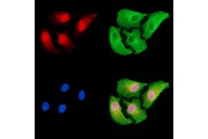 ABIN7094985 and ABIN7099041 staining  cells by IF/ICC.