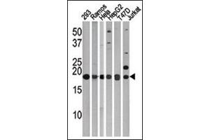 LC3C Antibody (APG8c) Cat. (LC3C Antikörper  (N-Term))