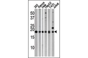 LC3C Antibody (APG8c) Cat. (LC3C Antikörper  (N-Term))