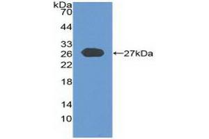 Western blot analysis of recombinant Human CYLD. (CYLD Antikörper  (AA 170-338))