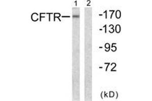 Western blot analysis of extracts from NIH-3T3 cells, using CFTR (Ab-737) Antibody. (CFTR Antikörper  (AA 711-760))