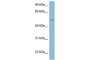 LBP antibody used at 1 ug/ml to detect target protein. (LBP Antikörper  (Middle Region))