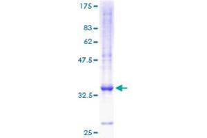 Image no. 1 for Chemokine (C-X-C Motif) Ligand 5 (CXCL5) (AA 1-114) protein (GST tag) (ABIN1350826)