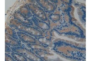 DAB staining on IHC-P; Samples: Rat Intestine Tissue (PLAT Antikörper  (AA 311-487))