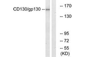 Western blot analysis of extracts from Jurkat cells, using CD130/gp130 (Ab-782) Antibody. (CD130/gp130 Antikörper  (AA 748-797))