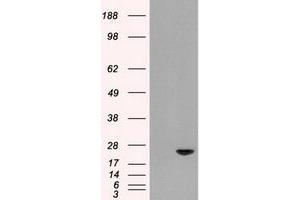 Image no. 1 for anti-Adenylate Kinase 1 (AK1) antibody (ABIN1496514) (Adenylate Kinase 1 Antikörper)