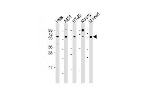 All lanes : Anti-CDC25B Antibody (Center) at 1:1000 dilution Lane 1: Hela whole cell lysate Lane 2: A431 whole cell lysate Lane 3: HT-29 whole cell lysate Lane 4: mouse lung lysate Lane 5: mouse heart lysate Lysates/proteins at 20 μg per lane. (CDC25B Antikörper  (AA 331-360))