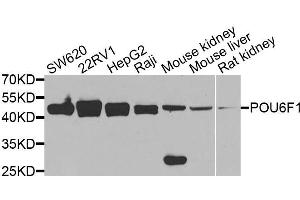 Western blot analysis of extracts of various cell lines, using POU6F1 antibody (ABIN5974401) at 1/1000 dilution. (POU6F1 Antikörper)