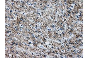 Immunohistochemical staining of paraffin-embedded liver tissue using anti-ATP5B mouse monoclonal antibody. (ATP5B Antikörper)