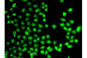 Immunofluorescence analysis of A-549 cells using E antibody (ABIN6127826, ABIN6139905, ABIN6139906 and ABIN6222933). (EAF2 Antikörper  (AA 1-170))