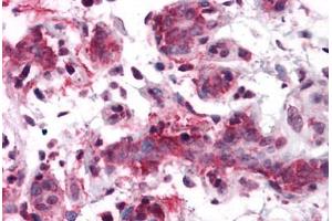 Human Breast: Formalin-Fixed, Paraffin-Embedded (FFPE) (RSPO1 Antikörper  (N-Term))