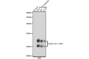 Western blot analysis of extracts of normal 293T cells and 293T transfected with NSP9 Protein, using SARS-CoV-2 NSP9 antibody (ABIN7268509) at 1:5000 dilution. (MHV NSP9 Antikörper)