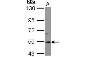 Image no. 2 for anti-Interleukin-1 Receptor-Associated Kinase 4 (IRAK4) (AA 27-288) antibody (ABIN1498897) (IRAK4 Antikörper  (AA 27-288))