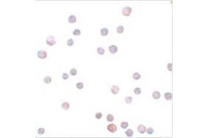 Immunocytochemistry of ZEB1 in HeLa cells with ZEB1 antibody at 20 μg/ml. (ZEB1 Antikörper  (Center))