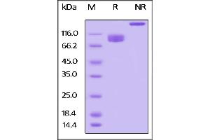 SDS-PAGE (SDS) image for Leukocyte Immunoglobulin-Like Receptor B3 (LILRB3) (AA 24-443) protein (Fc Tag,AVI tag,Biotin) (ABIN5526653)