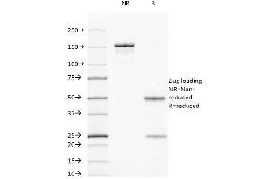 SDS-PAGE Analysis Purified Cytokeratin 7/17 Mouse Monoclonal Antibody (C-46). (Keratin 7/17 Antikörper)