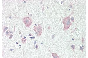 Rabbit Anti-DLG2 antibody  Formalin Fixed Paraffin Embedded Tissue: Human Brain, Cortex Primary antibody Concentration: 1:100 Secondary Antibody: Donkey anti-Rabbit-Cy3 Secondary Antibody Concentration: 1:200 Magnification: 20x Exposure Time: 0. (DLG2 Antikörper  (N-Term))