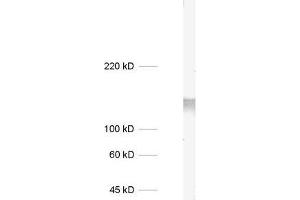 dilution: 1 : 1000, sample: mouse brain homogenate (STXBP5L Antikörper)
