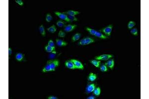 Immunofluorescent analysis of HepG2 cells using ABIN7171798 at dilution of 1:100 and Alexa Fluor 488-congugated AffiniPure Goat Anti-Rabbit IgG(H+L) (SLC26A8 Antikörper  (AA 414-595))