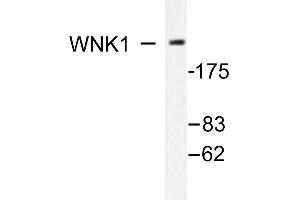 Image no. 1 for anti-WNK Lysine Deficient Protein Kinase 1 (WNK1) antibody (ABIN271862)