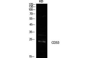 Western Blot (WB) analysis of KB cells using CD53 Polyclonal Antibody.