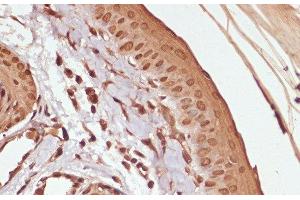 Immunohistochemistry (Paraffin-embedded Sections) (IHC (p)) image for anti-Catenin, beta (CATNB) (pSer33), (pSer37), (pThr41) antibody (ABIN7265240)