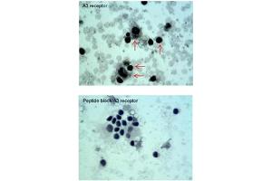 Sample type -- Oral Cell Carcinoma Dilution -- 5ug/mL (Adenosine A3 Receptor Antikörper  (C-Term))