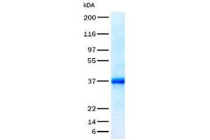 Validation with Western Blot (SPARC Protein)