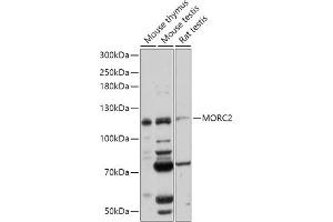 Western Blotting (WB) image for anti-MORC Family CW-Type Zinc Finger 2 (MORC2) (AA 60-250) antibody (ABIN7268683)