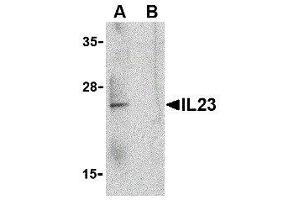 IL23 anticorps  (C-Term)