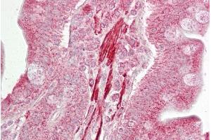 Immunohistochemistry with Small intestine tissue at an antibody concentration of 5µg/ml using anti-ROCK2 antibody (ARP61467_P050) (ROCK2 Antikörper  (Middle Region))