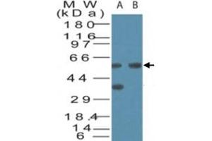 Western blot analysis of VDAC2 in human brain cell lysate in the A) absence and B) presence of immunizing peptide.