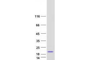 Western Blotting (WB) image for Protein Kinase (CAMP-Dependent, Catalytic) Inhibitor beta (PKIB) (Transcript Variant 2) protein (Myc-DYKDDDDK Tag) (ABIN2729034)