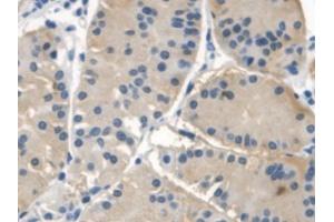 DAB staining on IHC-P; Samples: Human Stomach Tissue (NAIP Antikörper  (AA 923-1148))