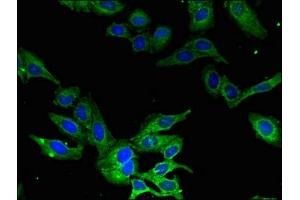 Immunofluorescent analysis of Hela cells using ABIN7146428 at dilution of 1:100 and Alexa Fluor 488-congugated AffiniPure Goat Anti-Rabbit IgG(H+L) (CAMK1 Antikörper  (AA 166-265))