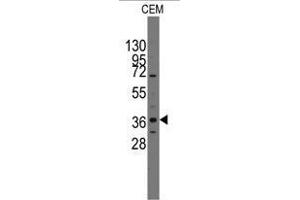 Image no. 1 for anti-Paired-Like Homeodomain 2 (PITX2) (C-Term) antibody (ABIN356913) (PITX2 Antikörper  (C-Term))