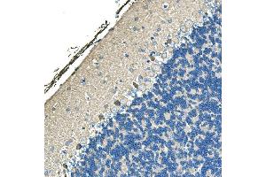 IHC analysis of Ankyrin Erythroid/ANK/ANK1 using anti-Ankyrin Erythroid/ANK/ANK1 antibody (ABIN7599959). (Erythrocyte Ankyrin Antikörper  (AA 1300-1844))