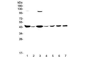 Western blot testing of human 1) HeLa, 2) placenta, 3) COLO-320, 4) SW620, 5) MDA-MB-231, 6) rat brain and 7) mouse brain lysate with CKB antibody at 0. (CKB Antikörper)