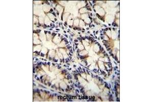 ECT2L Antibody (C-term) (ABIN655548 and ABIN2845057) immunohistochemistry analysis in formalin fixed and paraffin embedded human rectum tissue followed by peroxidase conjugation of the secondary antibody and DAB staining. (ECT2L Antikörper  (C-Term))