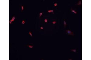 ABIN6267057 staining HT-1080 cells by IF/ICC. (Cyclin D1 Antikörper  (pThr286))