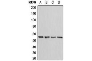 Western blot analysis of Calreticulin expression in HeLa (A), A431 (B), Raw264. (Calreticulin Antikörper  (N-Term))