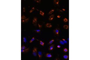 Immunofluorescence analysis of U-2 OS cells using LRRFIP2 antibody (ABIN7268214) at dilution of 1:100. (LRRFIP2 Antikörper  (AA 150-340))