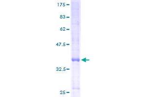 E2F2 Protein (AA 1-83) (GST tag)