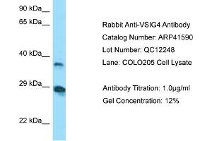 WB Suggested Anti-VSIG4 AntibodyTitration: 1.