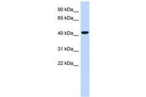 Image no. 1 for anti-Sphingomyelin Synthase 2 (SGMS2) (AA 71-120) antibody (ABIN6741219) (Sphingomyelin Synthase 2 Antikörper  (AA 71-120))