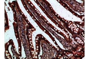 Immunohistochemical analysis of paraffin-embedded human-small-intestine, antibody was diluted at 1:200 (FABP2 Antikörper  (AA 90-132))