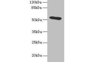 Western blot All lanes: Hpx antibody at 4. (Hemopexin Antikörper  (AA 24-460))