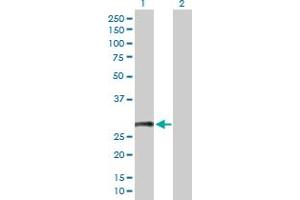 Western Blot analysis of CD8B expression in transfected 293T cell line by CD8B MaxPab polyclonal antibody. (CD8B Antikörper  (AA 1-243))